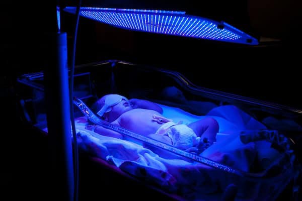 Baby with jaundice under phototheraphy treatment